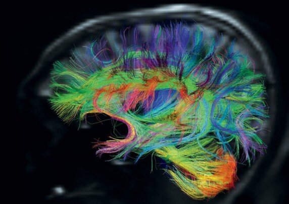 brain