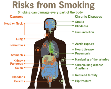 Risks from smoking