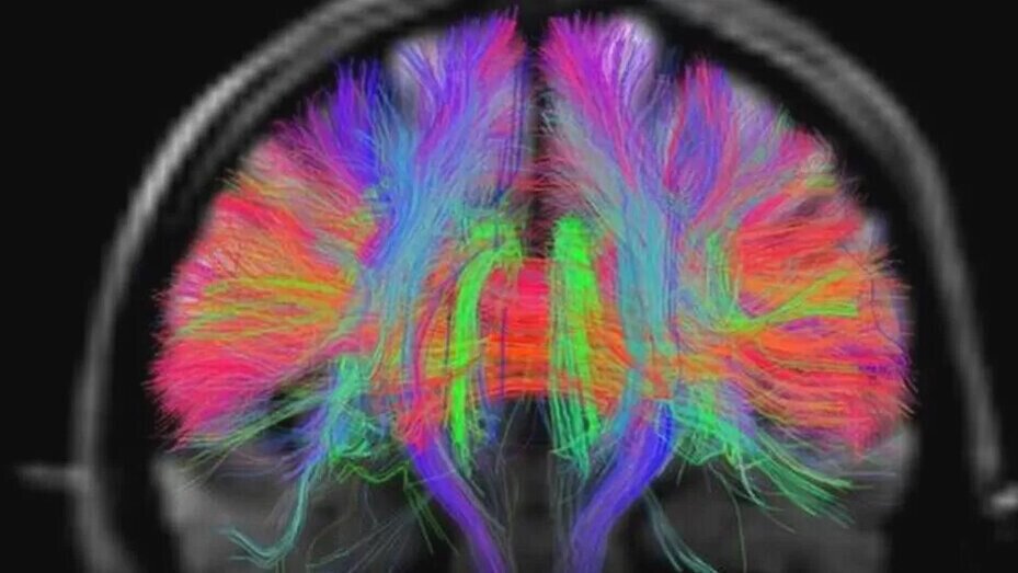 Brain