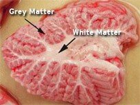 brain